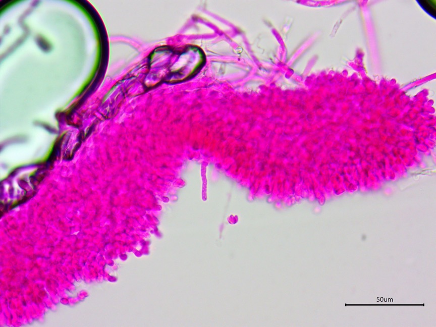 Athelia salicum sidebar image 6 - leptocystidia of Athelia salicum