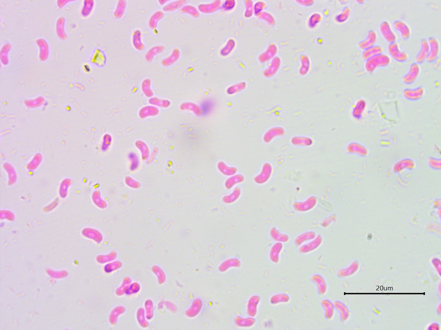 Galzinia incrustans sidebar image 5 - basidiospores of Galzinia incrustans