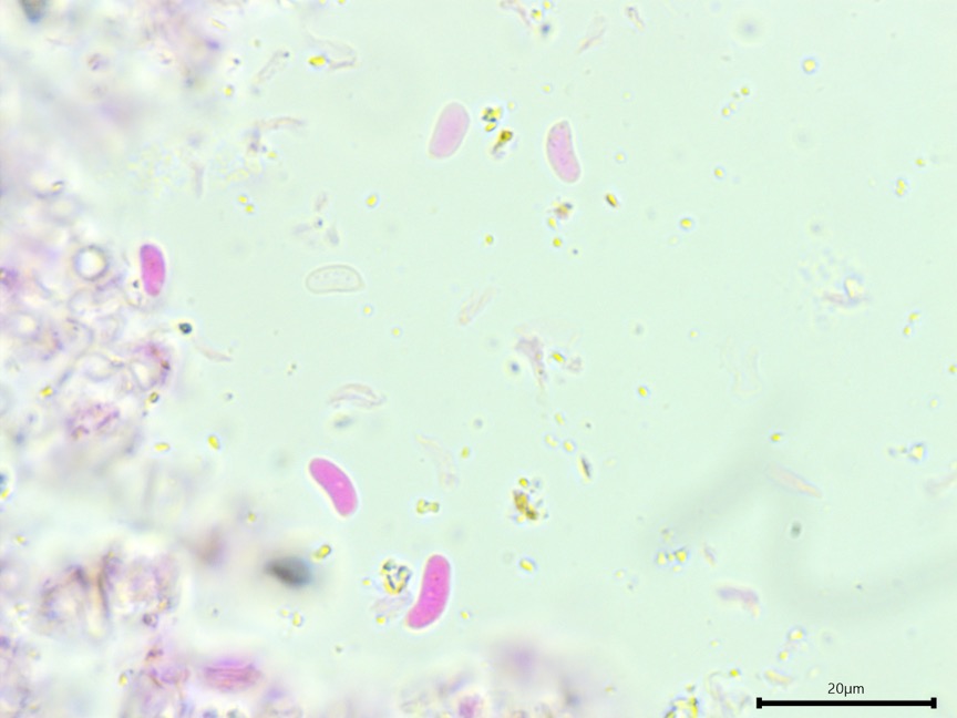 Peniophora cinerea sidebar image 5 - basidiospores of Peniophora cinerea