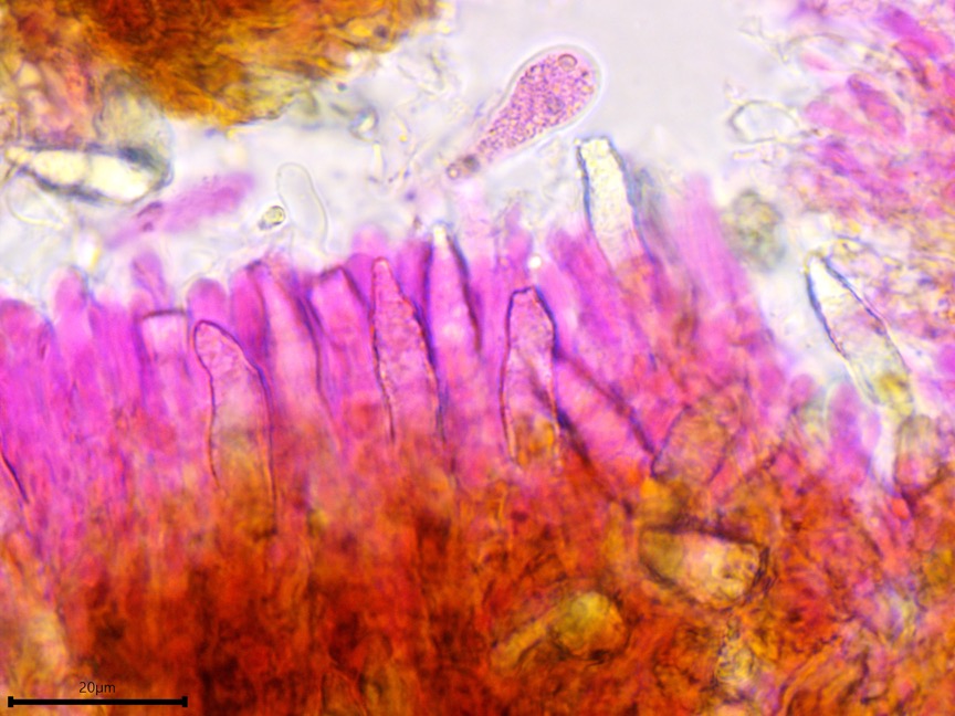 Peniophora cinerea sidebar image 9 - cystidia of Peniophora cinerea