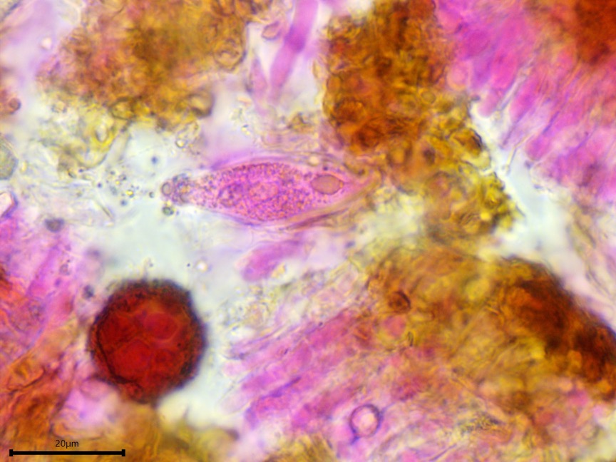 Peniophora cinerea sidebar image 11 - gloeocystidia of Peniophora cinerea