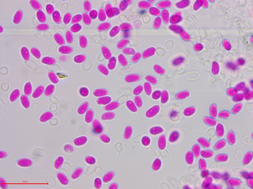 Punctularia strigosozonata sidebar image 11 - basidiospores of Punctularia strigosozonata