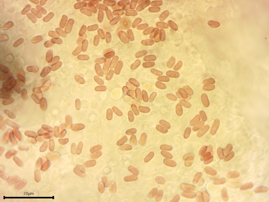 Sarcoporia polyspora sidebar image 9 - basidiospores of Sarcoporia polyspora