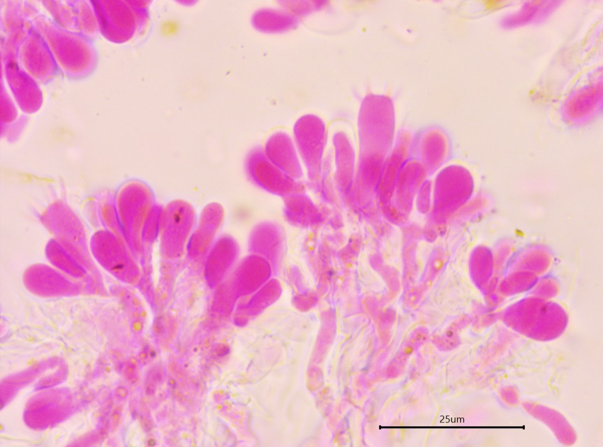 Sistotremastrum guttuliferum sidebar image 4 - basidia of Sistotremastrum guttuliferum