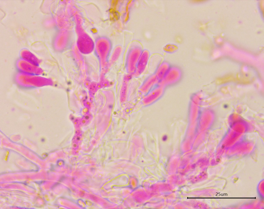 Sistotremastrum guttuliferum sidebar image 6 - hyphae of Sistotremastrum guttuliferum